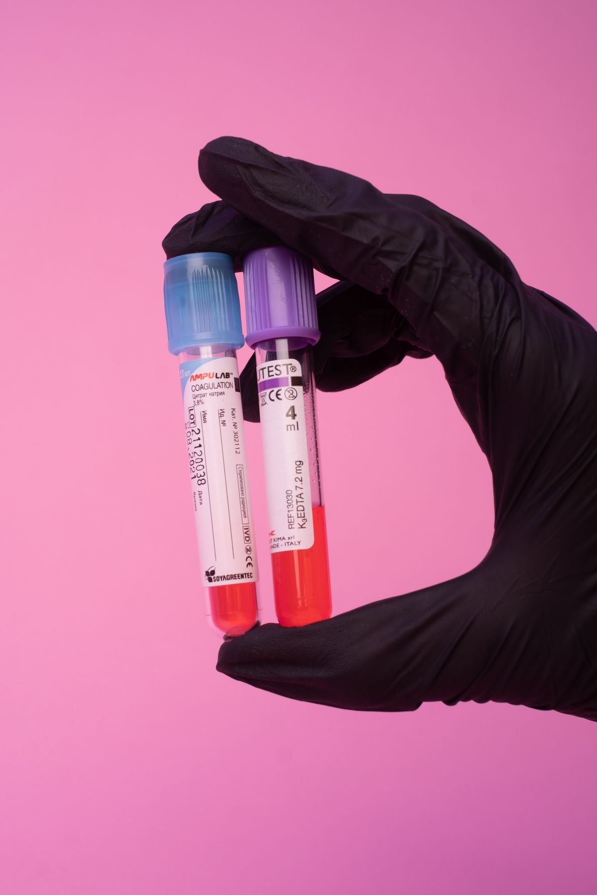 Blood test being taken during pregnancy for gestational diabetes screening