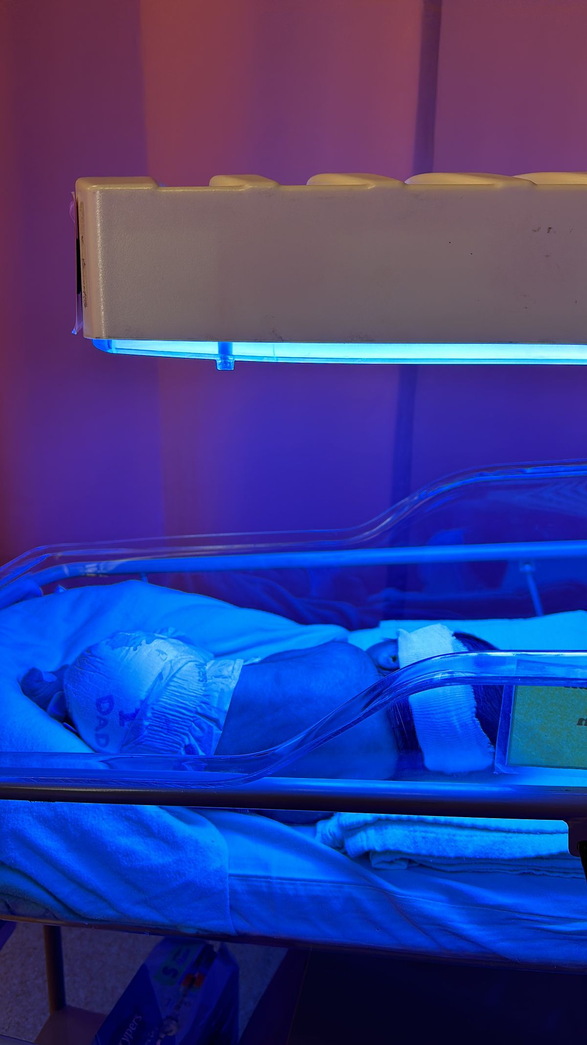 Newborn receiving phototherapy treatment for jaundice in hospital